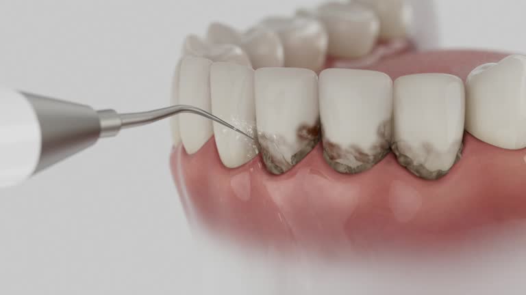 Trusted Teeth Whitening service in Powhatan Point, OH - Dentist Open Now